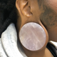 Image for article titled A Rather Unique Coming Out on Dr. Pimple Popper